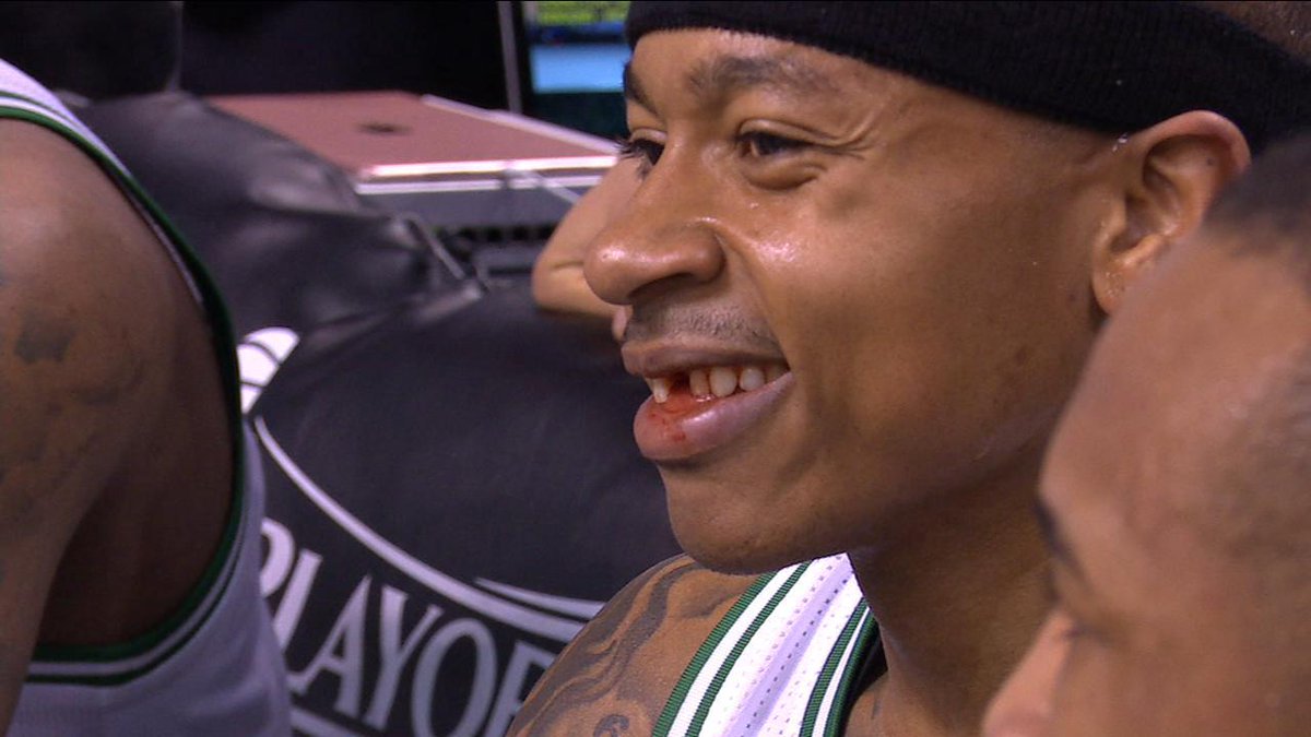 BigDogsTrading's tweet image. No tooth - no problem #Celtics