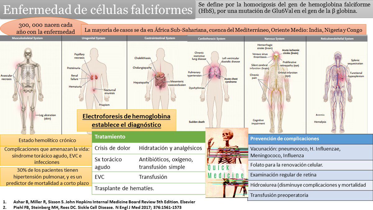 anemia de células falciformes rasgo diagnóstico de diabetes anemia de células falciformes rasgo diagnóstico de diabetes