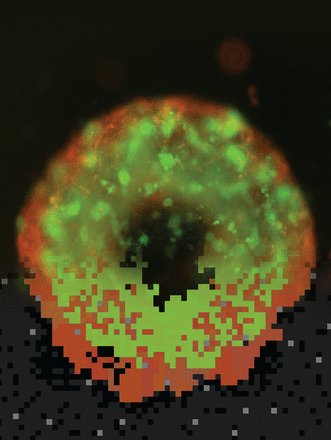 Our new paper on the cover of <a href="/AACR/">AACR</a> Cancer Research! Novel Insights into Intratumoral Evolution cancerres.aacrjournals.org/content/77/9/2… A 1st for <a href="/mathonco/">IMO</a>!