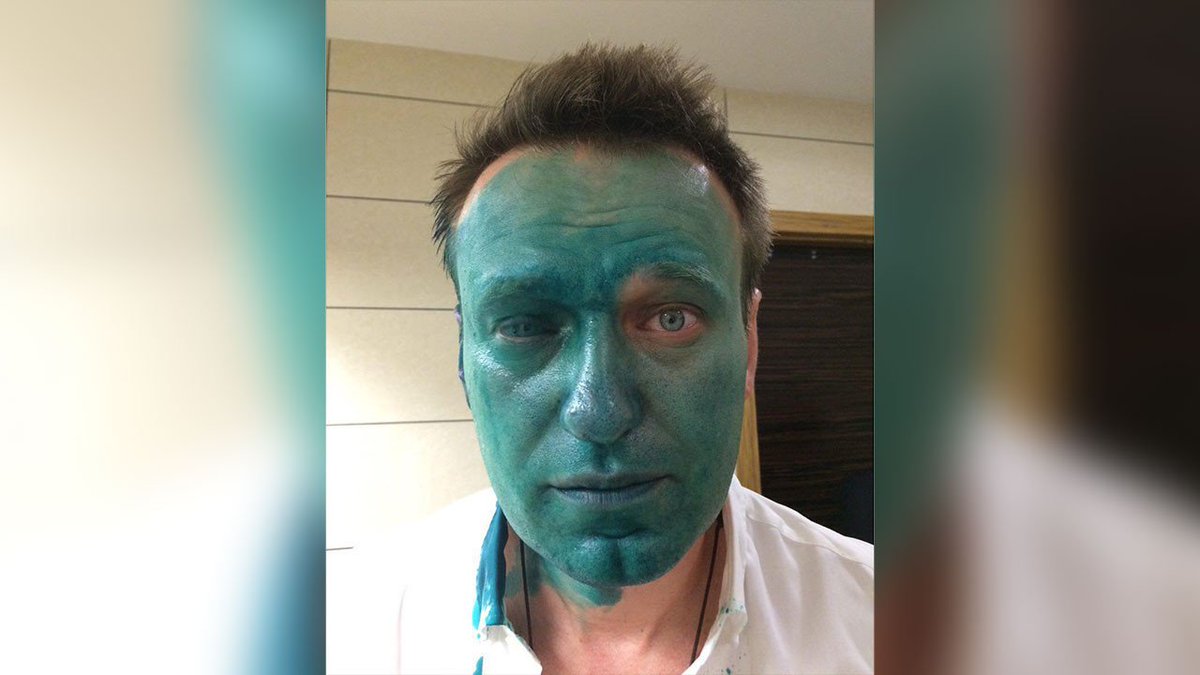 Зеленеет какое лицо. Навального облили зелёнкой.