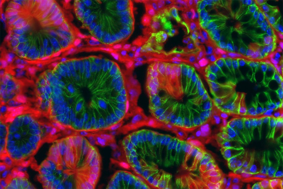 Best of both worlds - KI's <a href="/jatinroper/">Jatin Roper</a>, <a href="/ohyilmaz/">Omer Yilmaz</a> et al's new technique to improve understanding of colon cancer bit.ly/2pAx5XP