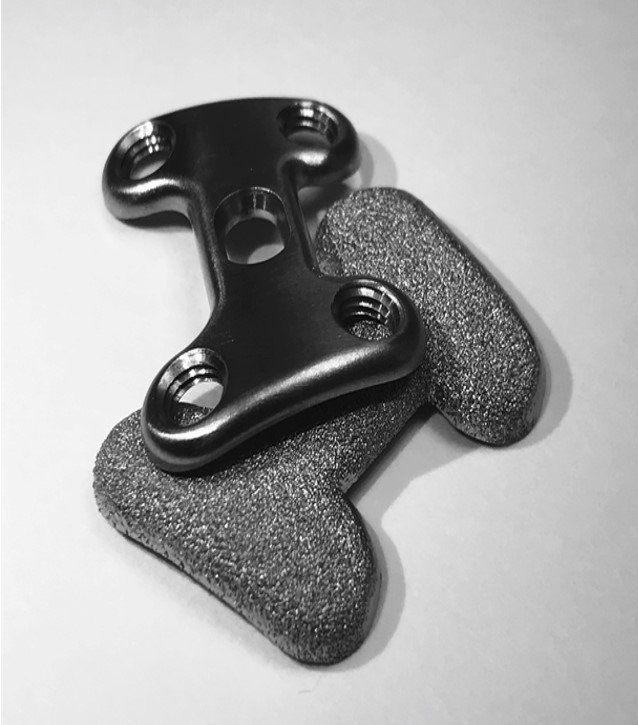 ExpandableSWI's tweet image. FDA clears the first 3D plates for general use in the lower extremity orthostreams.com/2017/04/fda-ap… #AdditiveOrthopaedics #device #surgical #med