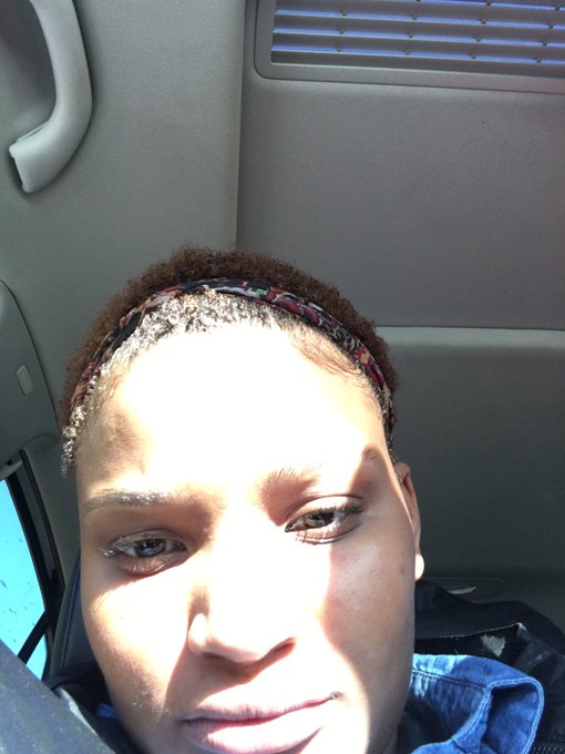 Hey y'all update on my clear skin https://t.co/Fecc5HhWnD<a href="/tag/newprofilepic"class="tags"><span>#newprofilepic</span></a>