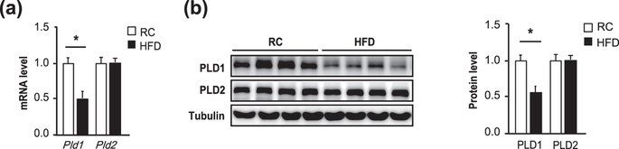 lipidchronicles's tweet photo. PLD1 deficiency in mice causes non-alcoholic fatty liver disease through an autophagy defect https://t.co/q9Xvkfa1Fl (@SciReports) https://t.co/QB47x2igFa