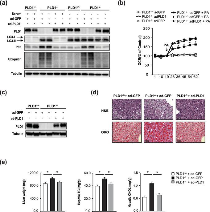 lipidchronicles's tweet photo. PLD1 deficiency in mice causes non-alcoholic fatty liver disease through an autophagy defect https://t.co/q9Xvkfa1Fl (@SciReports) https://t.co/QB47x2igFa