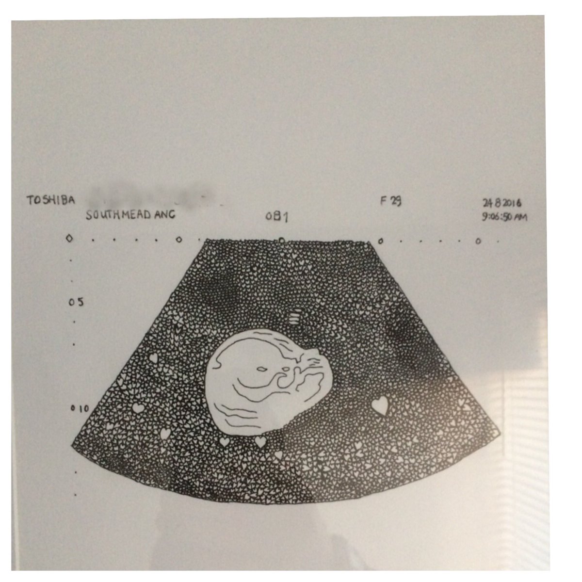 ADHDFatherUK's tweet photo. *Best xmas gift* Was a drawn picture of our #scanphoto from my brother. #baby https://t.co/rx2xuo4nHX