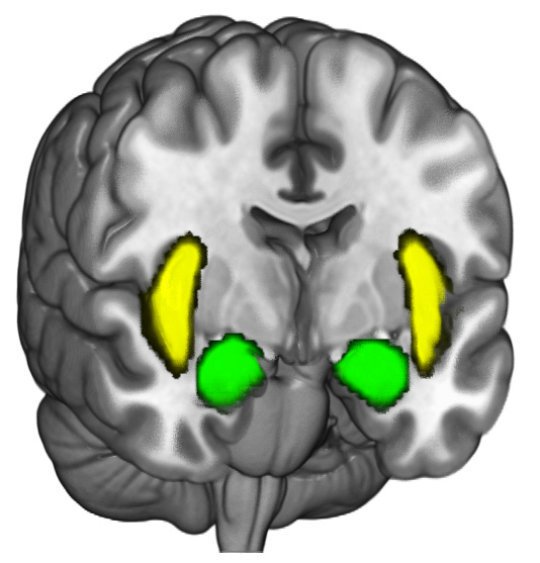 Xavi_Bros's tweet photo. Who's not able to change their political/religious #beliefs has more activity in the #amygdalae and #InsularCortex: https://t.co/HAyUtc2kYe https://t.co/8p3lBJJiJb
