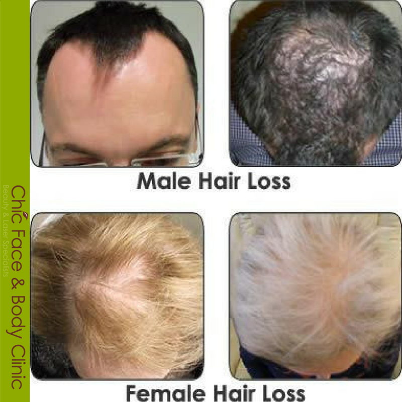ChicFaceAndBody's tweet photo. Are you ready for thicker and longer hair in 2017? The earlier you start, the faster you'll get results! https://t.co/MPjfo2N52H