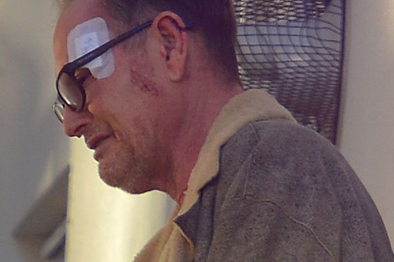 DailyMirror's tweet image. Tearful Gazza seen bleeding and gaunt in first pics since hotel brawl mirror.co.uk/news/uk-news/w…