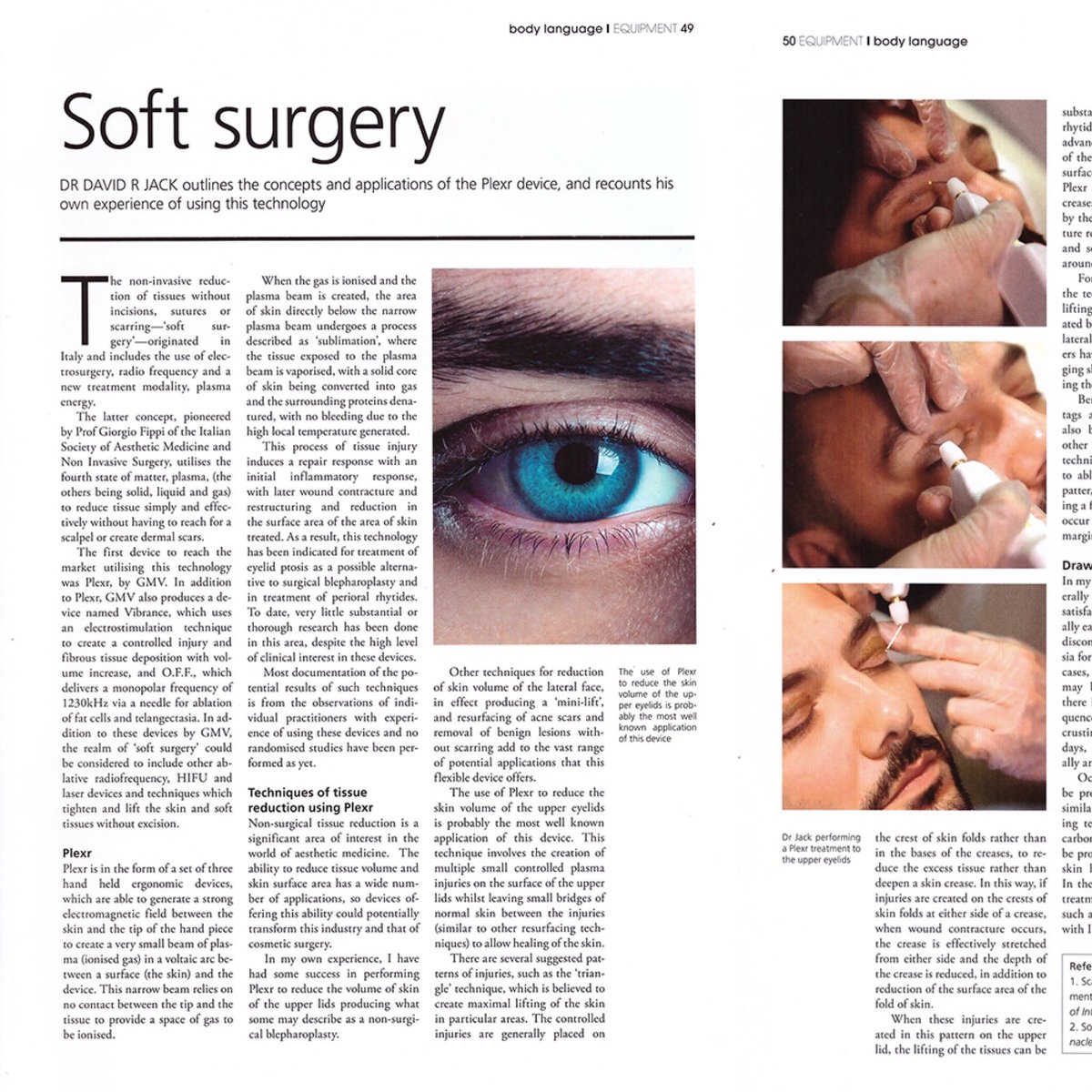FusionGtUk's tweet photo. Thank you to @drdavidjack for the brilliant article @bl_journal #Plexr #Plasma #SoftSurgery #NonSurgicalBlepharoplasty #UltimatePlasmaDevice https://t.co/PRCBORaH5g