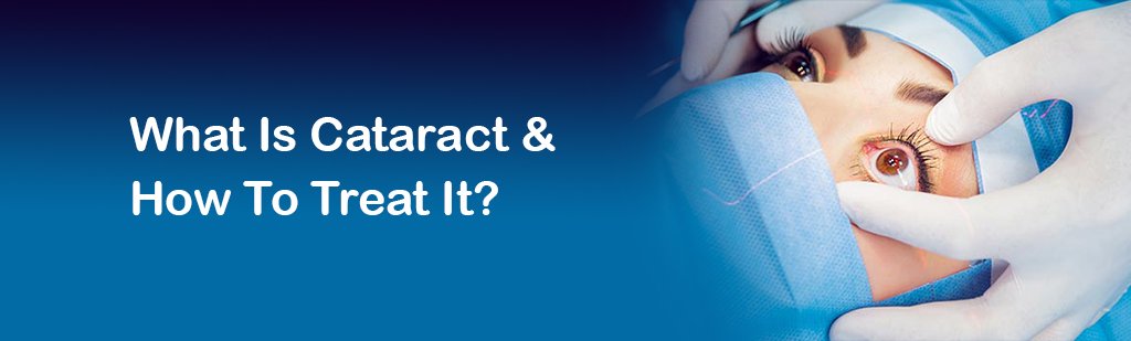 See this blog on What Is Cataract & How To Treat It? by #MahaveerEyeHospital in #Pune #punecity #MyPune #PunePulse goo.gl/SiFF26.