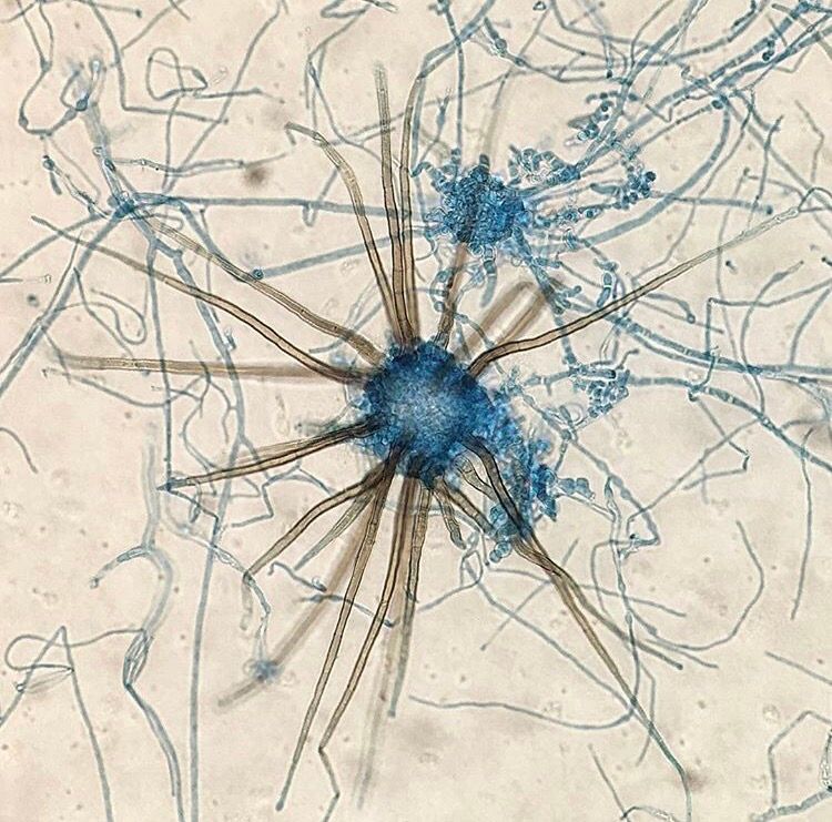 JMGardnerMD's tweet image. Incredible pic of Chaetomium #fungus by Eileen Rojas. Reminds me of a multi leg starfish. #Pathology #microbiology