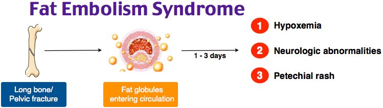 Image result for FAT EMBOLISM