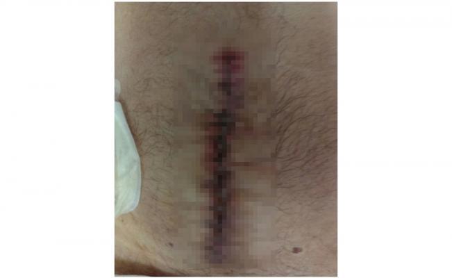 El_Universal_Mx's tweet image. #Historia "Los enfermeros y doctores sólo se echan la bolita y dejan morir lentamente a los pacientes” eluni.mx/2hR4eHW