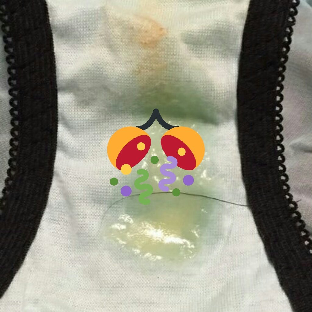 ZixBro's tweet photo. https://t.co/tKDq5Pq9xM