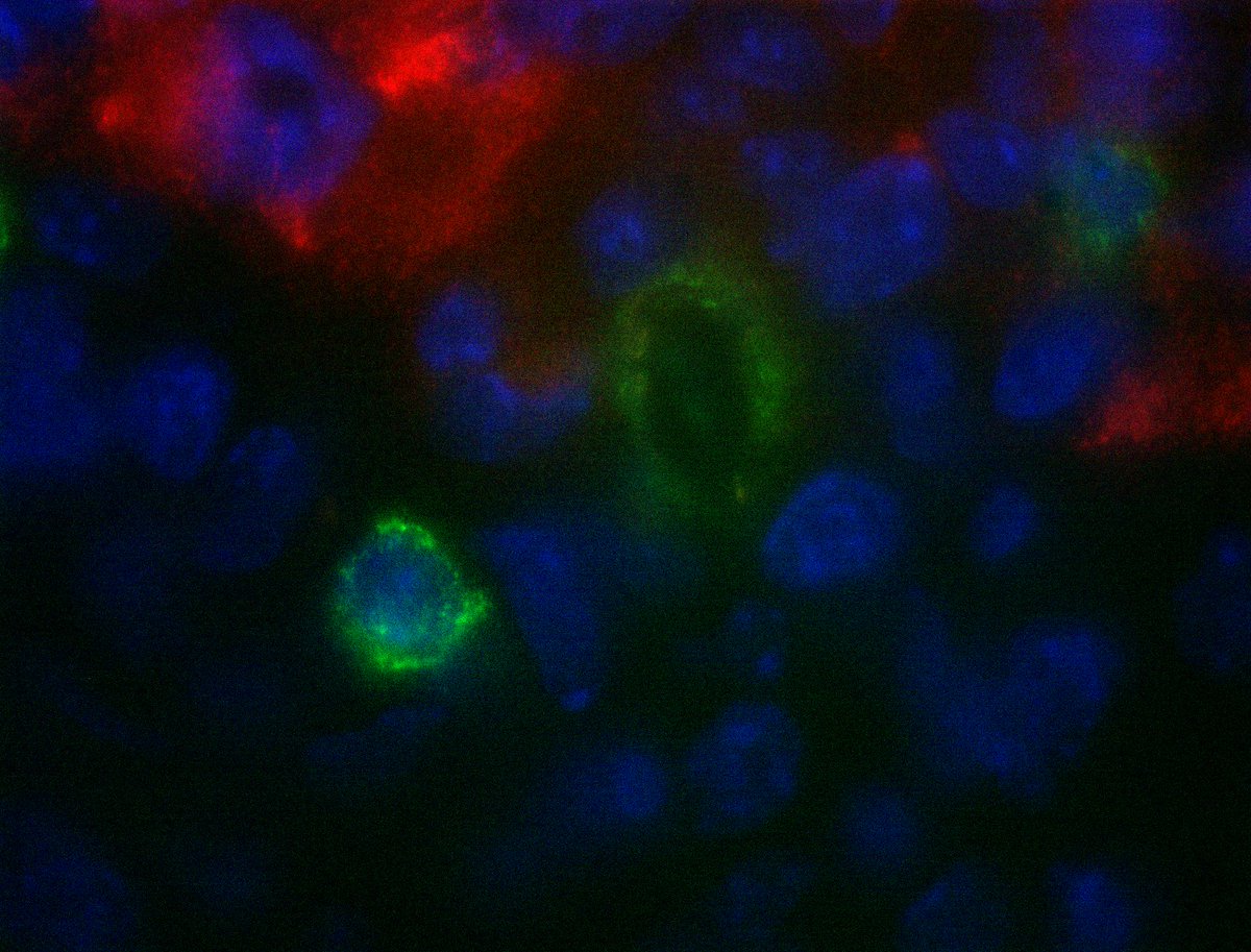 bioSyntagma's tweet photo. bioSyntagma has created a tool to answer the big questions in science that can lead to cures for cancer, diabetes, and alzheimers. #moonshot https://t.co/nvANSbOD6a