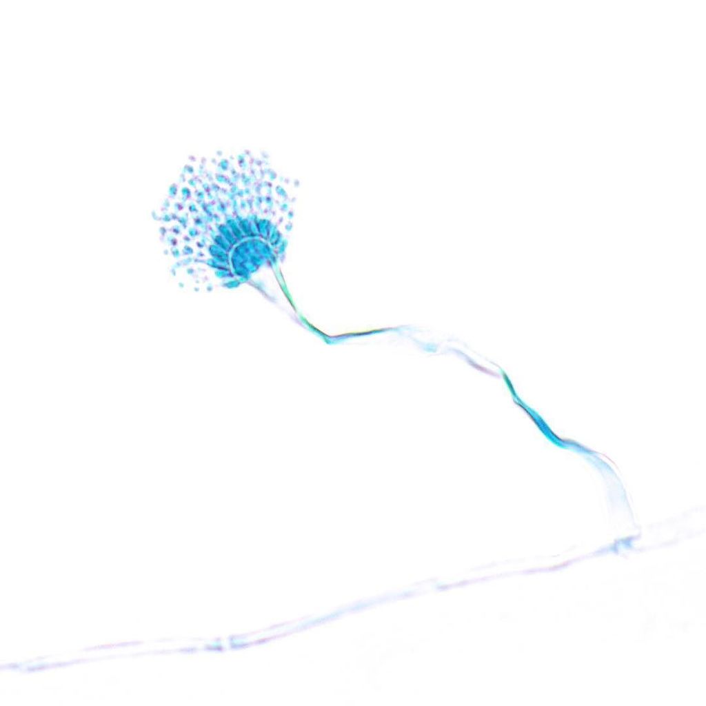glomerulove's tweet photo. 🍄 Aspergillus fumigatus 🍄 stained with #aniline #blue ... named for the color of the colon… https://t.co/FEAeWIO5Op https://t.co/zZFHZ7Yo4a