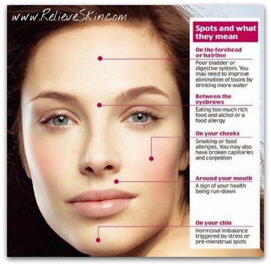 michellesnatur1's tweet photo. Did you know... Ecza-Mend helps control #acne by balancing the skin's oil production! https://t.co/QsFFeozUSD