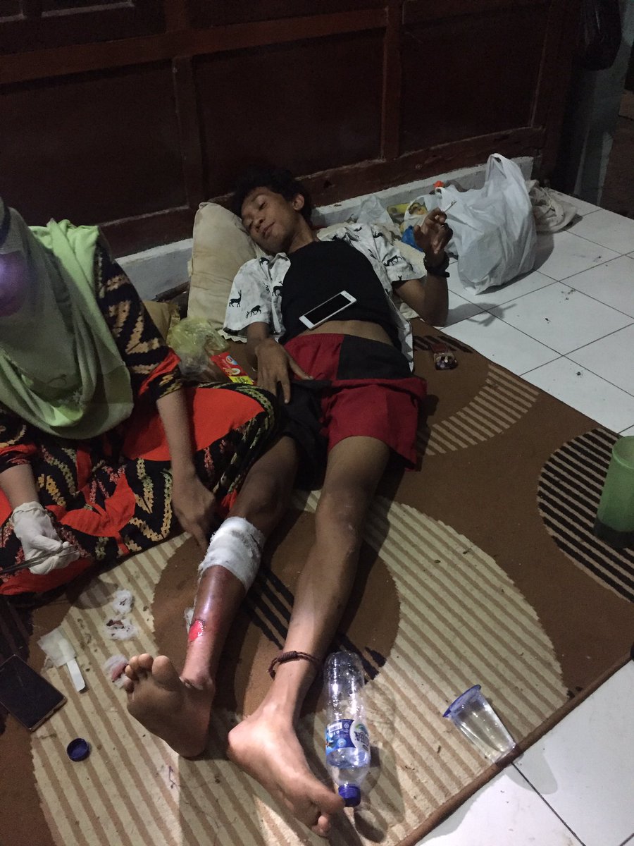 JCI_Bima's tweet photo. Mohon doanya salah satu relawan dari @JCI_Bima mendapat musibah kulit terbakar akibat motor yg di gunakan pada saat baksos  tadi terbakar https://t.co/KhRLWCiiQg