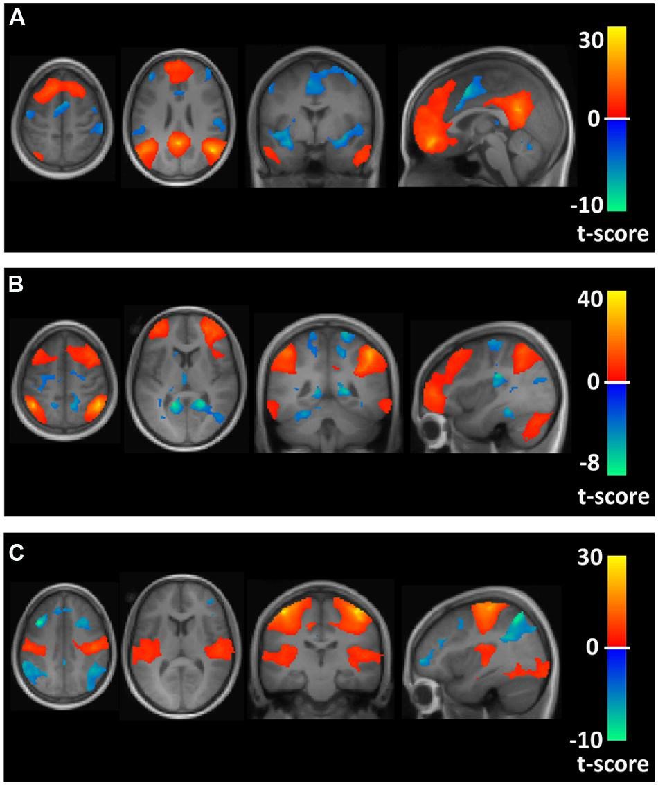 HealthScAcademy's tweet image. Runners’ brains may have greater connectivity. Continue reading here >> thehealthsciencesacademy.org/science-catch-… #RunnersBrain #BrainFunctions