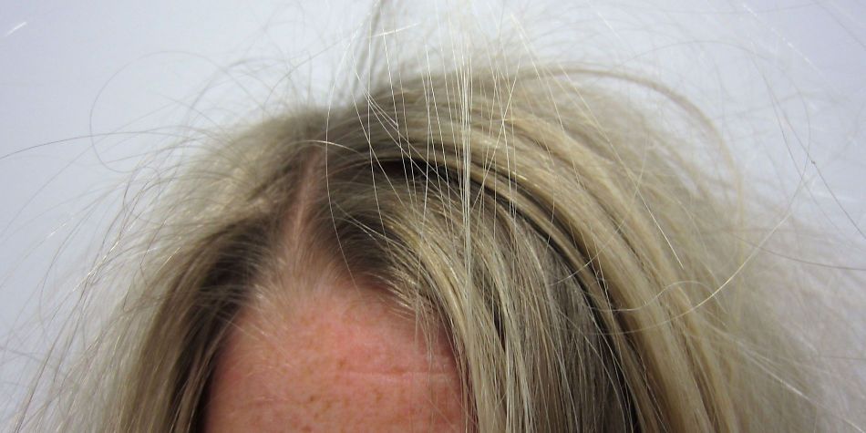 Danger: High Voltage ⚡⚡⚡ Slik behandler du elektrisk hår i tørr vinterluft! buff.ly/2hIfNAL