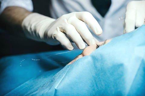 HBHealthClinic's tweet image. Silhouette Soft® has been used for several years in Europe and Asia. #silhouettesoft #SkinRenewal #facialthreads #a hbhealthofknightsbridge.co.uk/thread-lift/