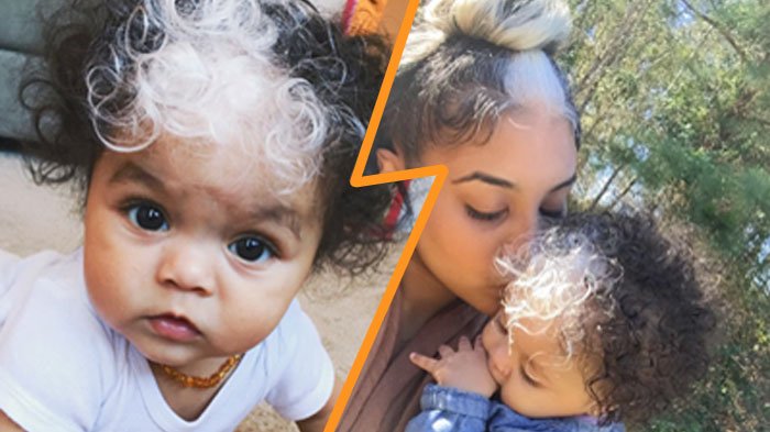 SmartHairExtens's tweet photo. This is so neat! Baby Born With A White Patch Of Hair Which Is Exactly The Same As Her https://t.co/PkTiJI0Lbb... https://t.co/PDwxtiFm2b