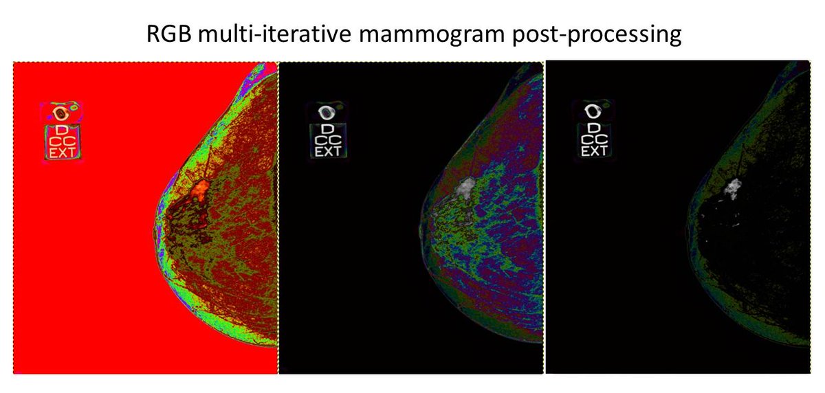 breast_imaging's tweet photo. #postproceso RGB multi-iterativo en #mamografia https://t.co/kirU3QZKif