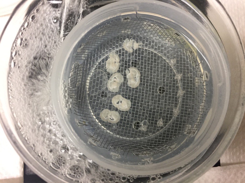 dhsimmons1's tweet photo. Live from the lab: 12 brain slices! #neuroscience #brainbath #bubblebath 👩🏻‍🔬 https://t.co/iZCqMCjGmy