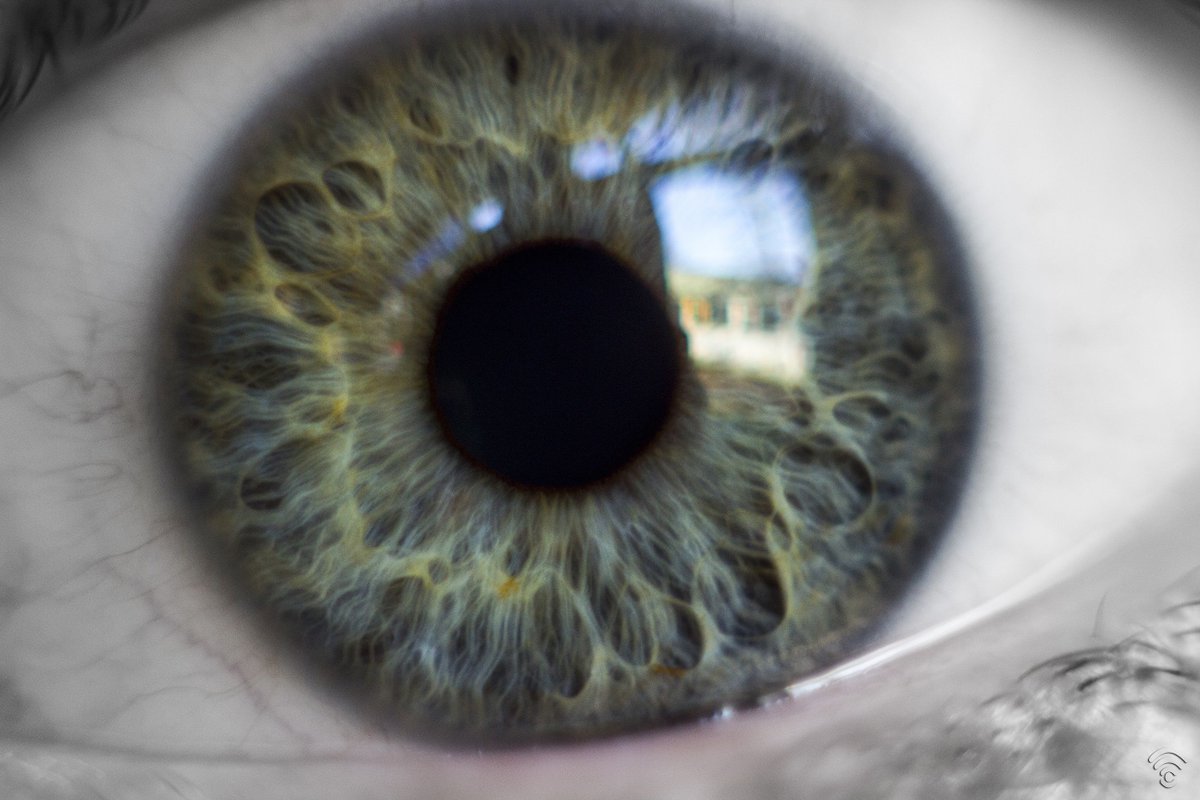 глаза без оболочки