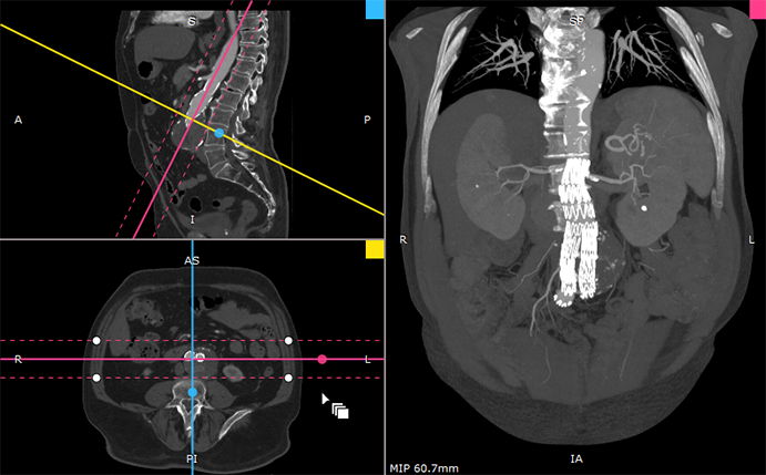 radiantviewer's tweet image. RadiAnt DICOM Viewer BETA 3.9.15 - further improvements in 3D MPR/MIP viewer - radiantviewer.com/thread.php?id_…