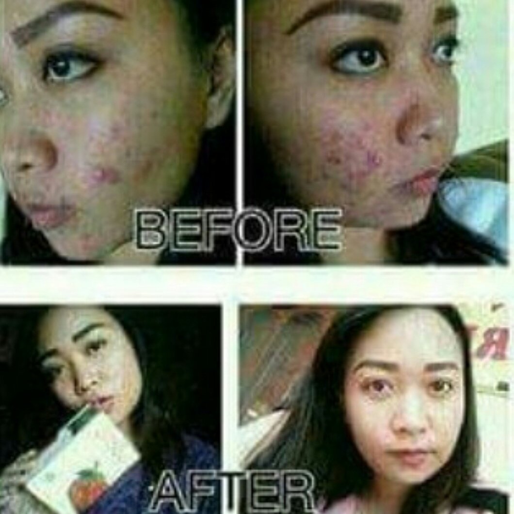 Koleksi Dp Bbm Fakta Anak Pertama