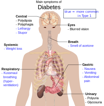 stuartketley1's tweet photo. You CAN SERIOUS REDUCE your #diabetes damage… https://t.co/eBhZsS34Cz

#type2diabetes #type1diabetes #treatment https://t.co/eeDwKctnhr