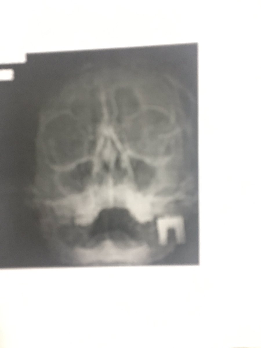 Че это такое?🙁 хорошо, что в больнице мест нет и меня отпустили домой😖