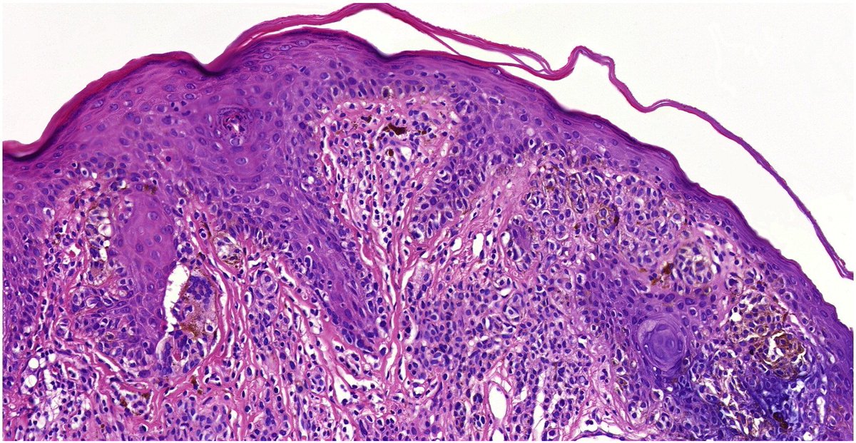 PathologyTweet tweet picture
