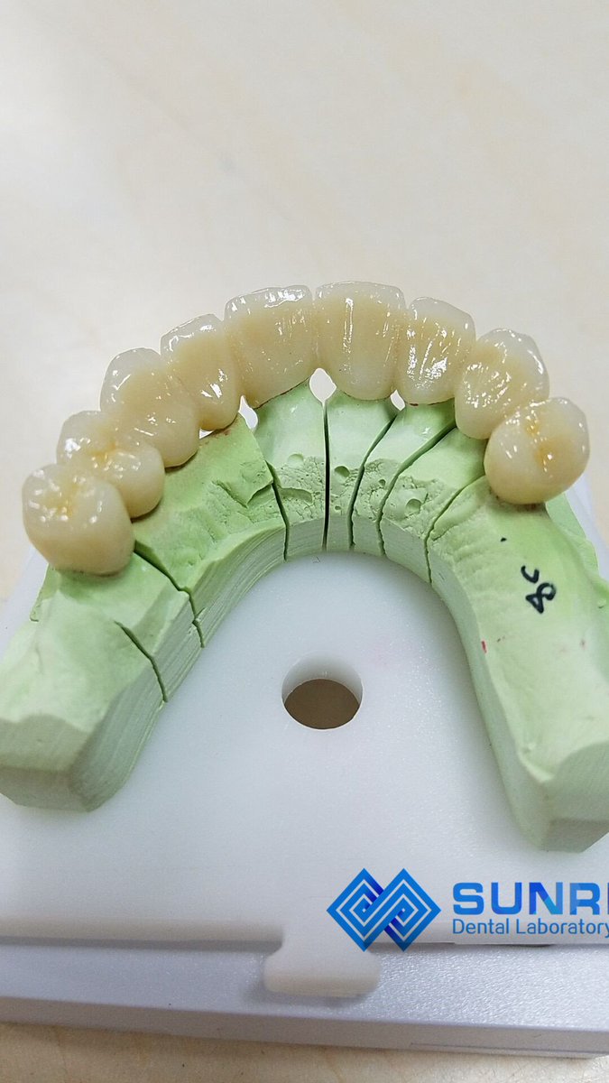 Shane380750926's tweet photo. @jsamano7 Sunrise Dental Laboratory in HK
!! Free shipping 
shane@sunrisedentallab.com.hk https://t.co/hMC0ffLyYF