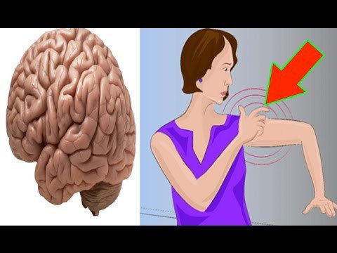 treatmentherbs's tweet photo. One Month Before Stroke , Your Body Will Send You These Warning Signs – Don’t Ignore Them - https://t.co/kF8E2Nlxi5 https://t.co/4EgZ9OEsPp