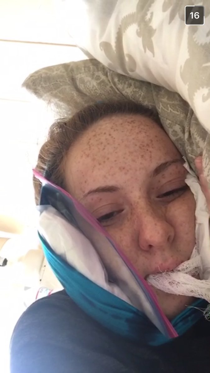 clarabellee8's tweet photo. it's too bad i wasnt able to witness this in person!!!!! or help you change your gauze :( however, 8 days until i see my fave!! @masha_rut https://t.co/cyyhJ90qMB