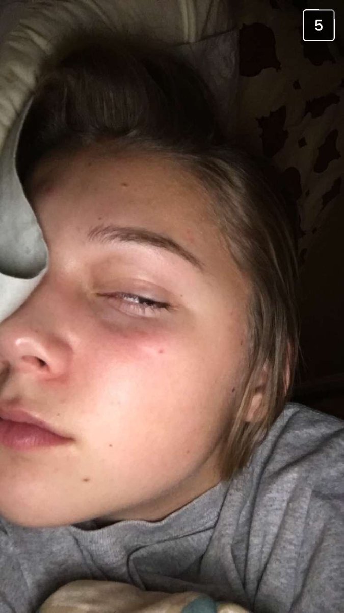 bmo_syd's tweet image. See what had happened was... Brooke almost died and yeah and wufnekdjgktksfjgjrjcjfiekskx