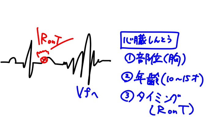 【心臓震盪は、、、はじめの一歩は嘘やぞ】