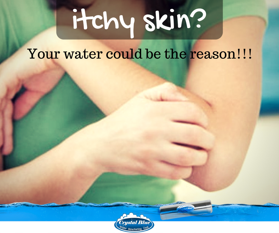 CrystalBlueIND's tweet photo. Do u have itchy/dry skin? Is cold weather increasing dryness of ur skin?
Have u considered that ur water could be a reason. #StructuredWater https://t.co/Caca09C0Pe