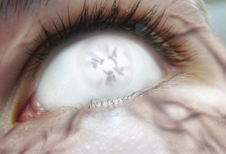 Eyes of the Shinobi World