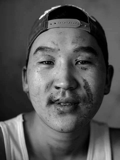 Улангассан улаан гал руу орж 3 хүүхдийн амь аварсан залуу гэнэ дээ. Нүүрэндээ шархтай ч нүдэндээ баяртай байгаа нь мэдрэгдлээ...