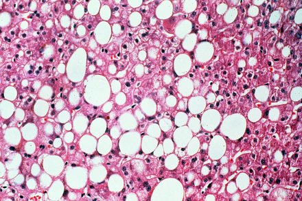 Vilo Kanis tweet media