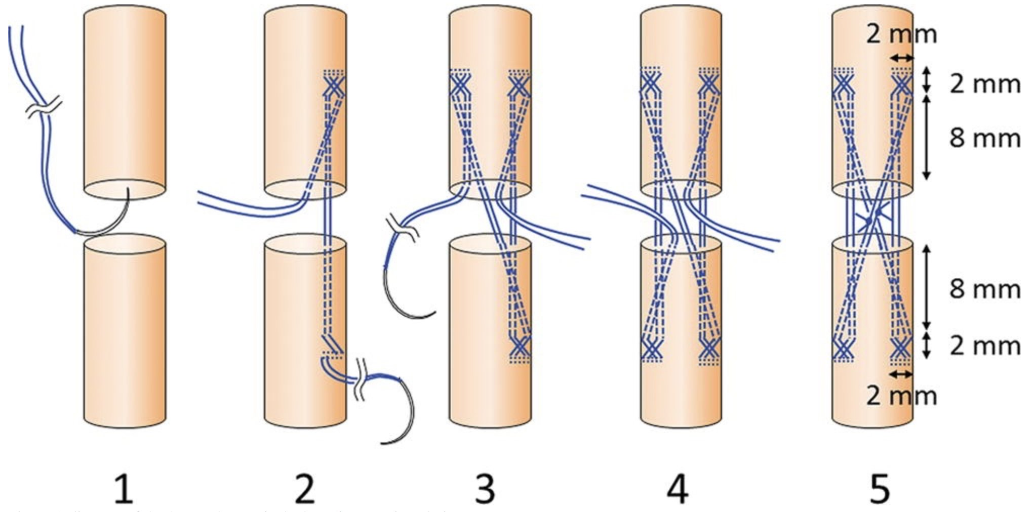 plastic-and-reconstructive-surgery-on-twitter-prsglobalopen-plastic