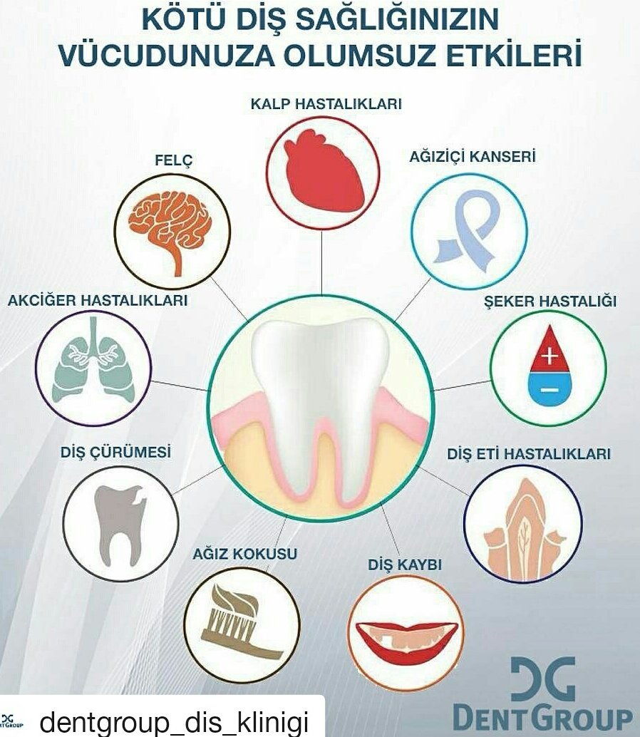 DentGroupAnt's tweet photo. DentGroup Antalya.
Lütfen ağız ve diş sağlığınızı ihmal etmeyin ! https://t.co/1eUPlL1Ijq