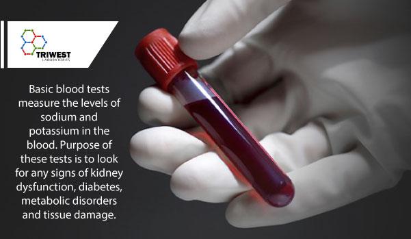 TriWestLabs's tweet photo. Basic #BloodTests look for any signs of #Kidney dysfunction, #diabetes, #metabolic disorders and #tissue damage. https://t.co/kVDwEkq9yF