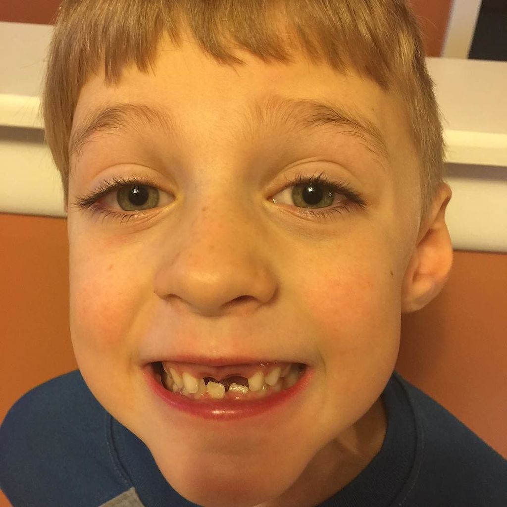 Levi_Herrin's tweet photo. All I want for Christmas is my 2 front teeth! #pulledtooth #toothfairy #bigmoney https://t.co/ss978itR8q https://t.co/X1t7QQr1cd