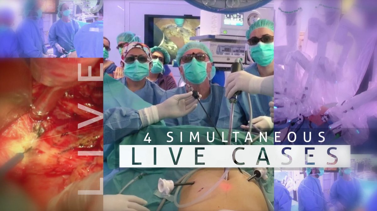 AntoniodeLacy's tweet photo. #Open vs #Laparoscopic vs #Robotic vs #TaTME challenge published for permanent viewing! at: https://t.co/EoiGxaw8el #colorectalsurgery https://t.co/8huXf4OJf2