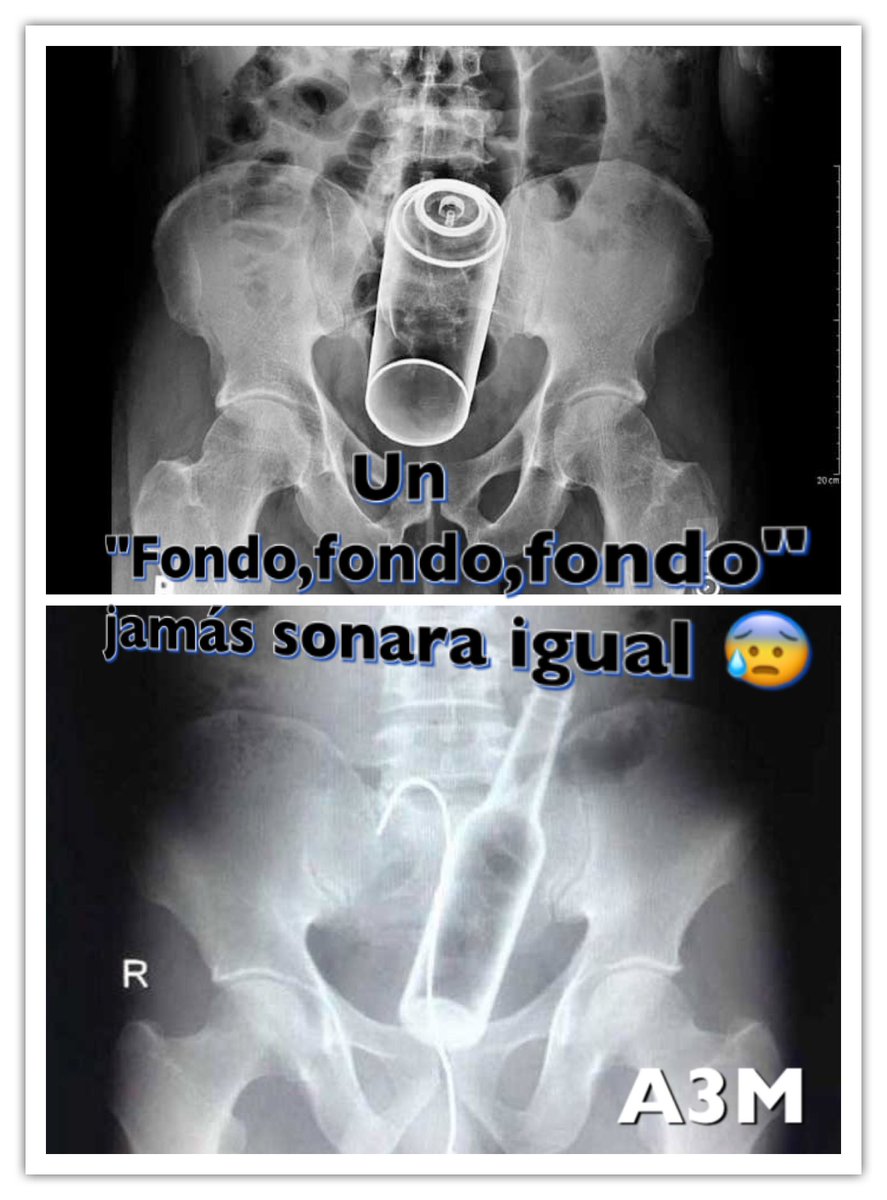 DraKetofol's tweet photo. "Fondo,fondo,fondo" jamás será lo mismo 🤣🤣🤣
#LOL 

#SabadoDeGanarSeguidores #UltimoSabado #Caso #Enarm2016 😘 https://t.co/FlyMDFuEEb